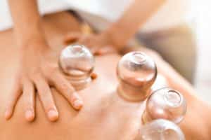 acupuncture cpt codes - cupping therapy