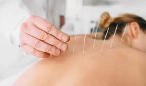 types of acupuncture treatments