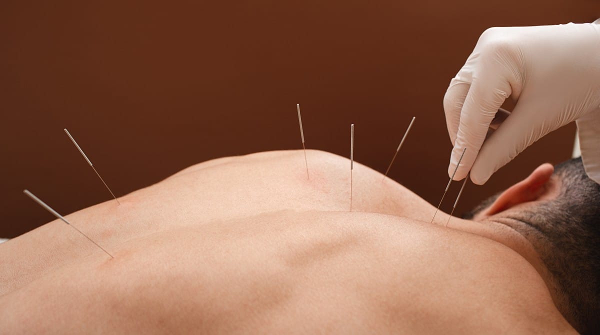 Acupuncture holistic patient care