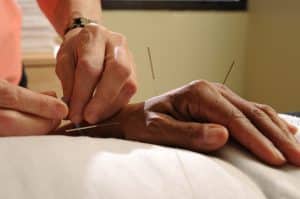 new medicare bill would expand acupuncture coverage