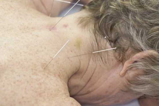 acupuncture has many benefits for seniors