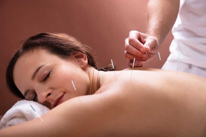 Close-up Of Relaxed Young Woman Going Through Acupuncture Treatment In Spa