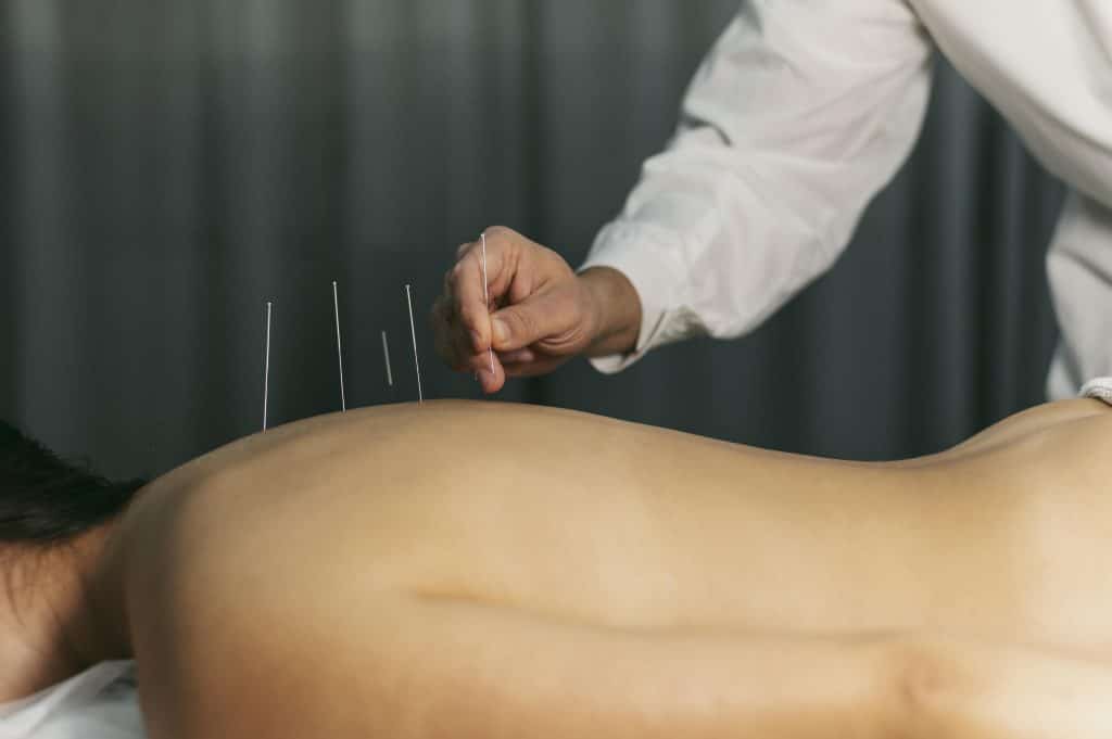 Acupuncture For Chronic Back Pain