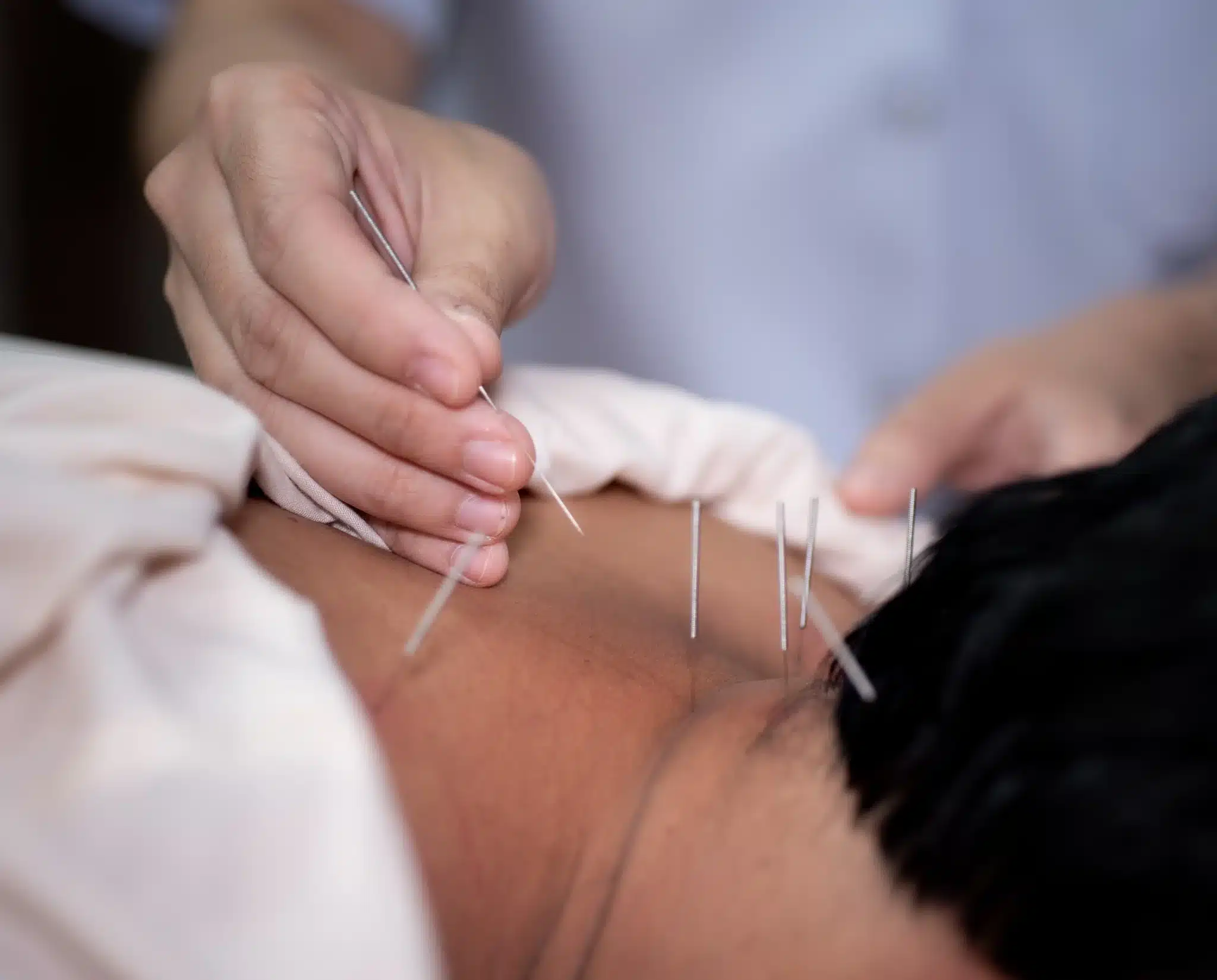 acupuncture liability insurance