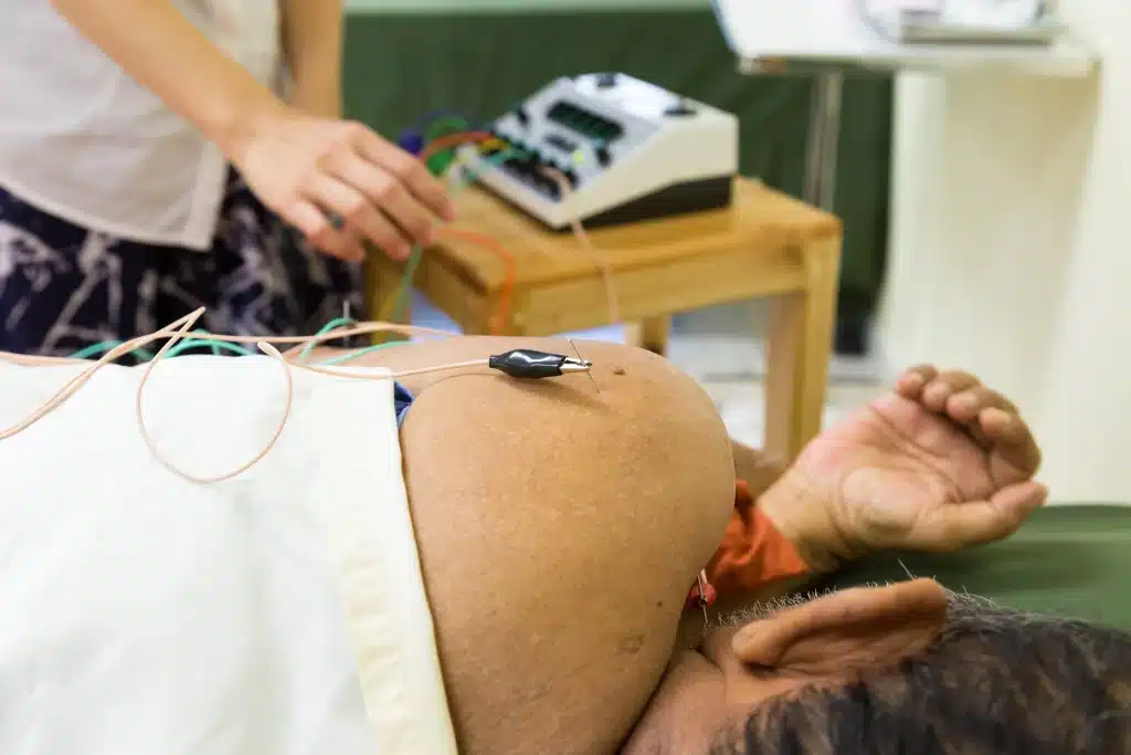 electrical stimulation therapy