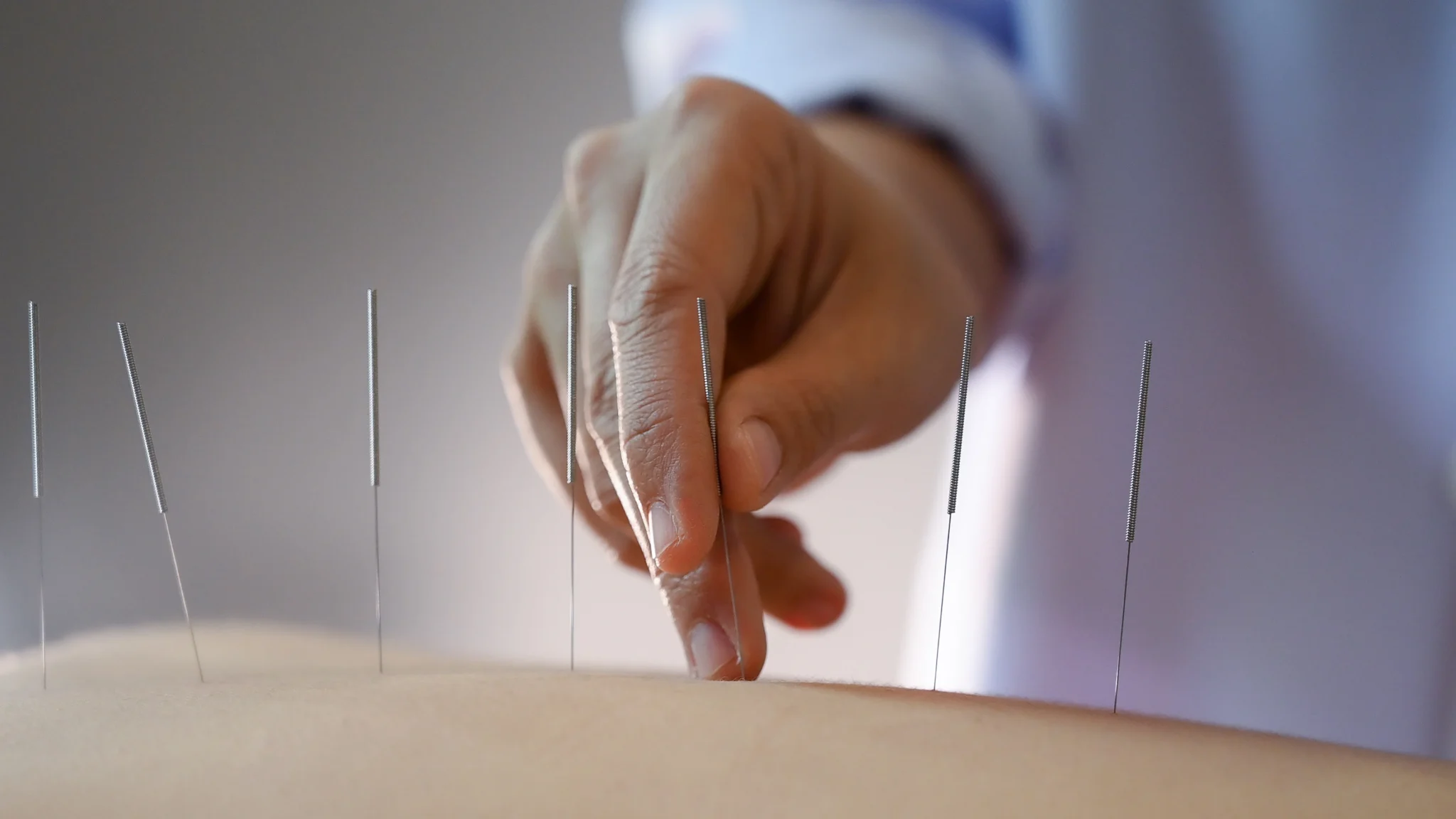 acupuncture billing services