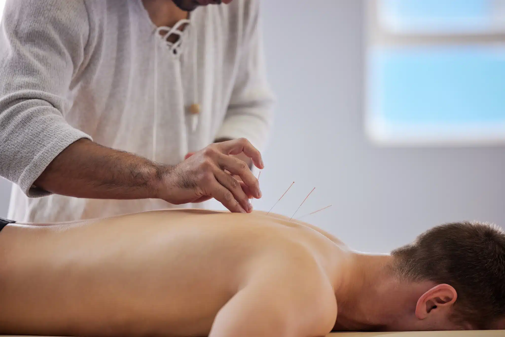acupuncture cpt codes