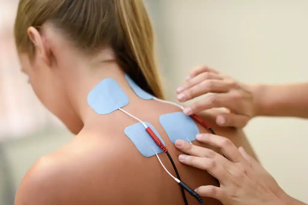 cpt code for acupuncture with electrical stimulation